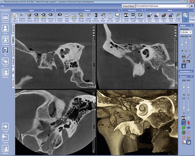 Planmeca ProMax 3D Max ear study