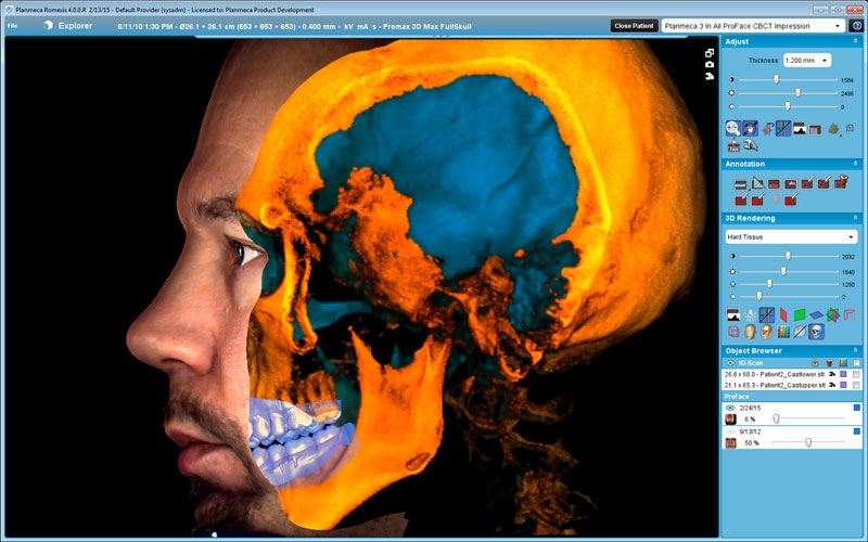 Planmeca ProMax 3D Max 3x3D
