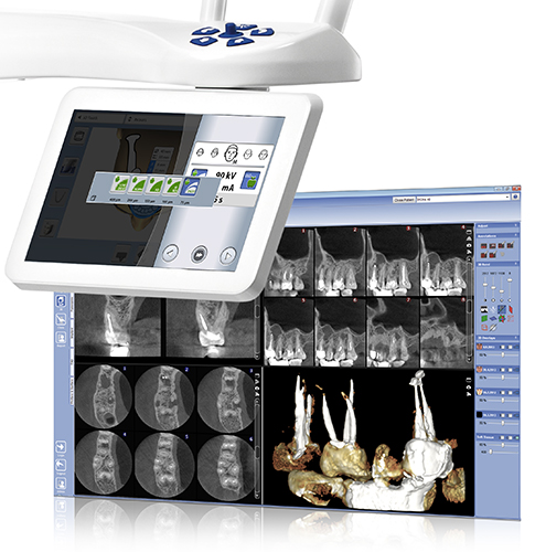 Endodontic imaging mode