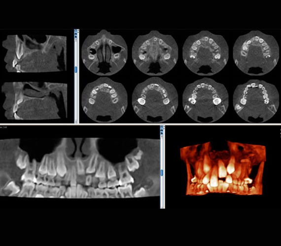 Planmeca Romexis orthodontics