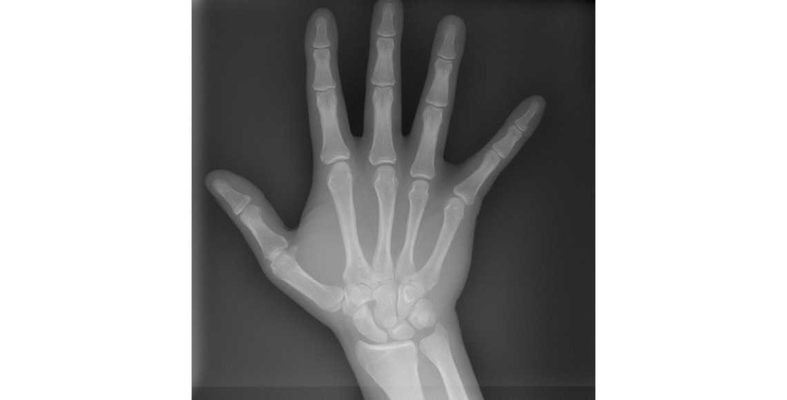 Planmeca ProCeph hand image