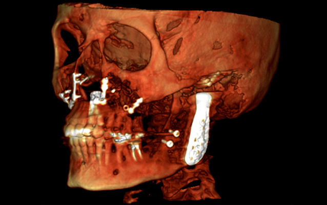 Planmeca Ultra Low Dose
