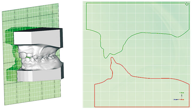 Planmeca Romexis 3D Ortho Studio