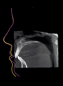 Pre and post-operative comparisons