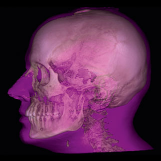 Visualise and measure airways and sinus volumes