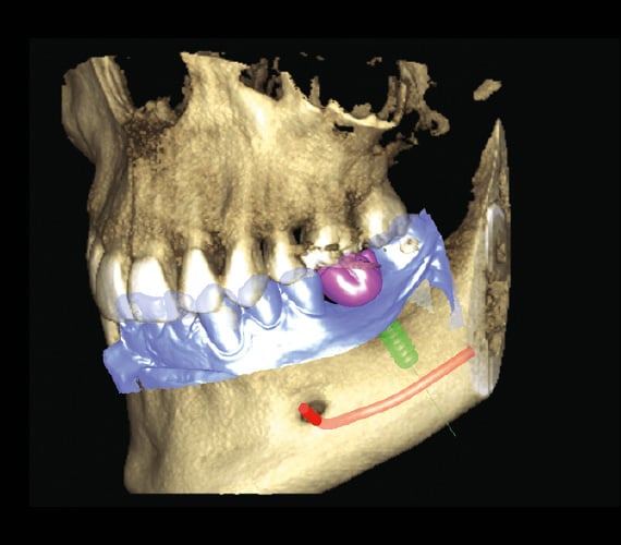 Planmeca ProMax 3D Classic imaging options
