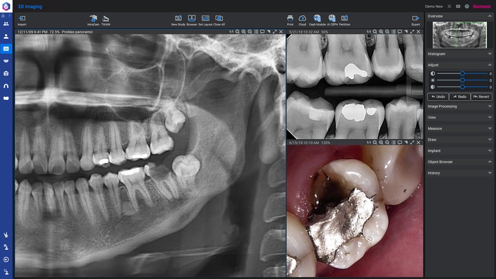 2d Imaging Software Planmeca Romexis