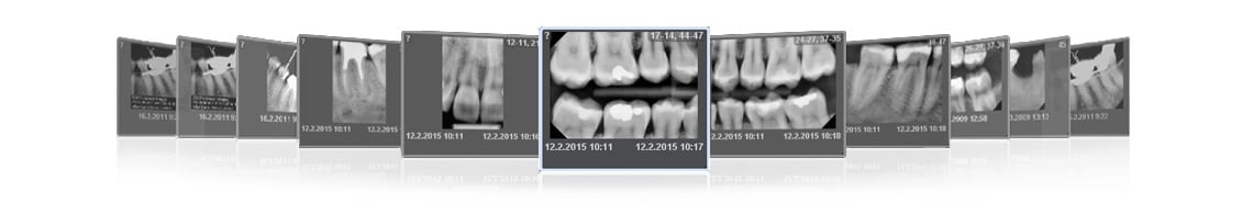 Planmeca ProX intraoral x-ray images