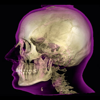 Visualise and measure airways and sinus volumes