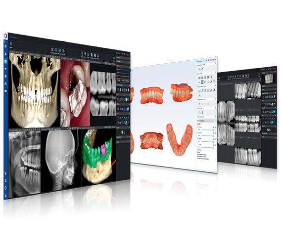 Planmeca Romexis all-in-one dental software