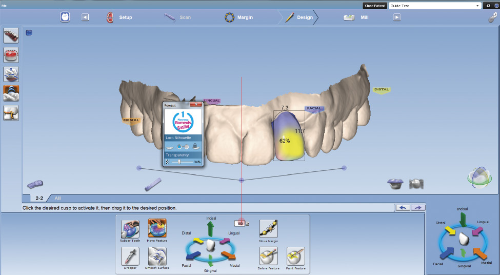 Planmeca Romexis implant workflow step 3