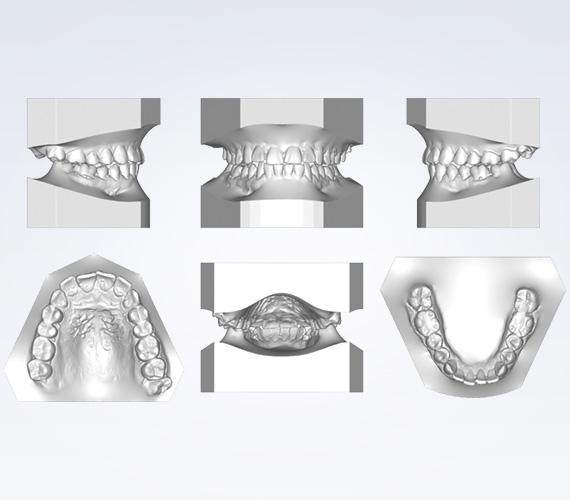 Planmeca Romexis Ortho Studio virtual preparation