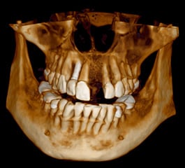 romexis-xfer-3d-rendering-style.jpg