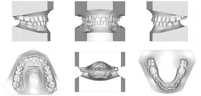 Planmeca Romexis 3D Ortho Studio