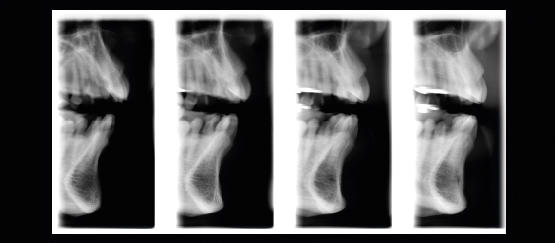 Cross-sectional tomography