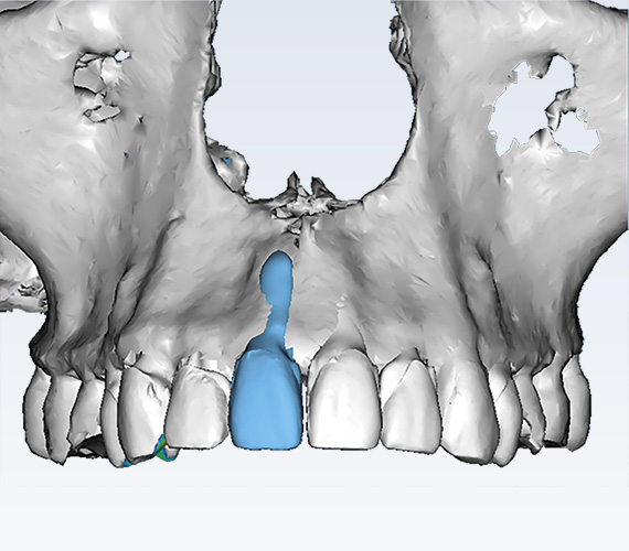 Planmeca Romexis Ortho Studio treatment planning