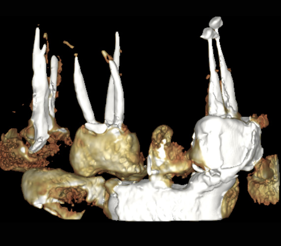 Planmeca Romexis endodontics