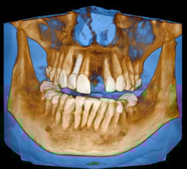 romexis-transparent-3d-rendering-style.jpg
