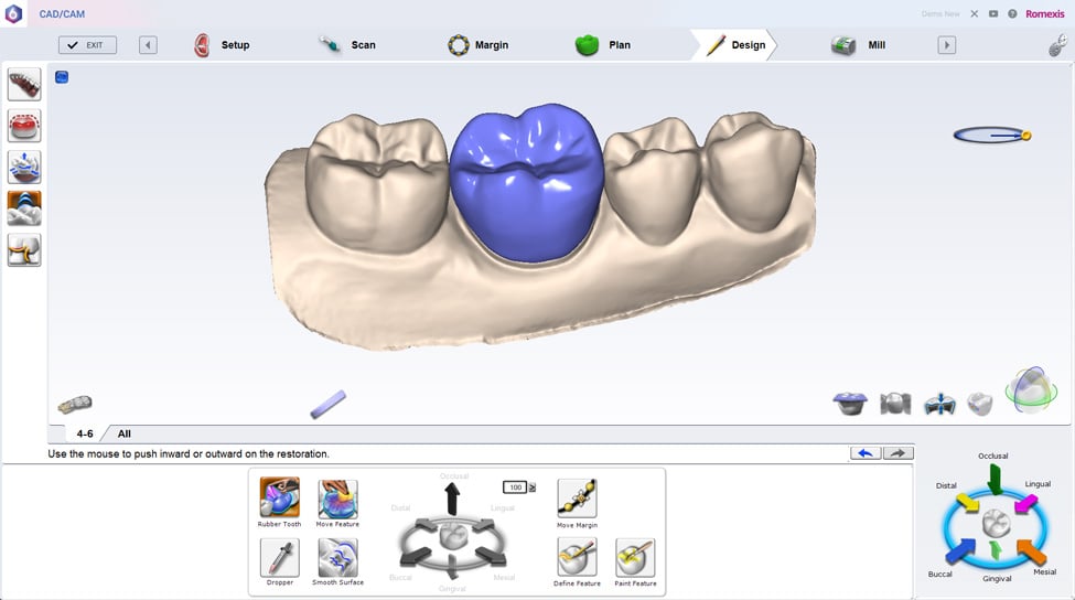 guerra Periodo perioperatorio Giro de vuelta Software de diseño dental de gran facilidad y eficacia | Planmeca PlanCAD  Easy