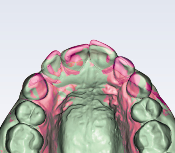 Planmeca Romexis Ortho Studio treatment follow up