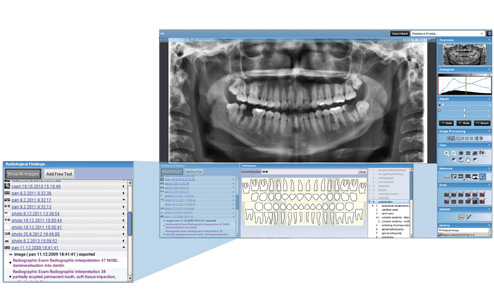 Romexis Radiological Findings module