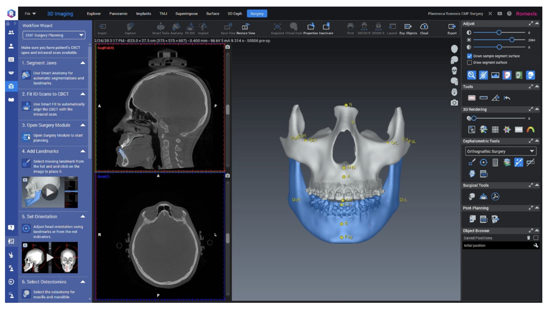 Romexis 7 software release (6.5.2)