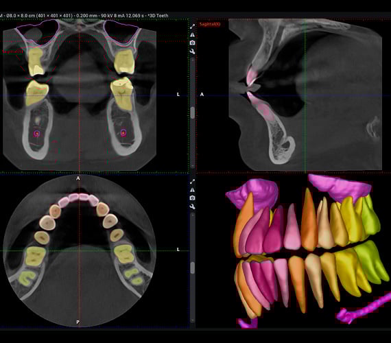 Romexis powered by AI