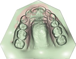 Planmeca Romexis 3D Ortho Studio