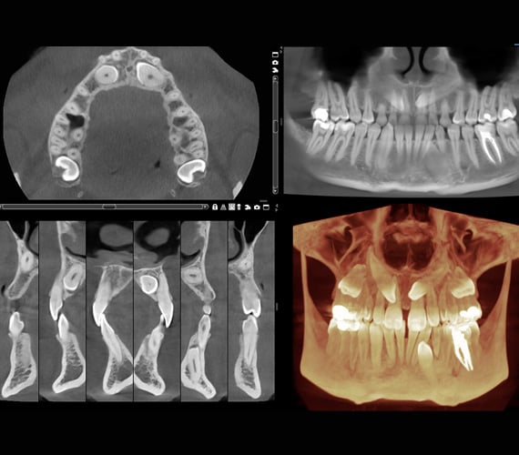 Planmeca Romexis 3D diagnostic tools