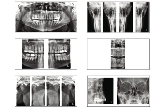 Planmeca ProMax 2D extensive imaging programs