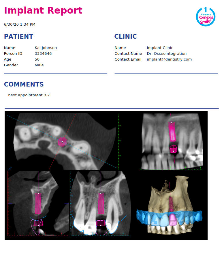 Planmeca Romexis implant report