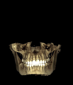 One imaging session generates both a 3D photo and a CBCT volume