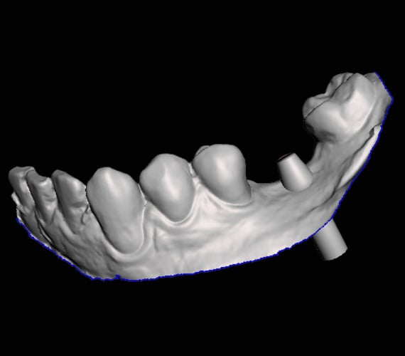 Planmeca Romexis open and compatible