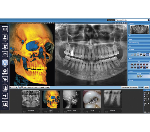 Planmeca ProMax 3D Max Superior CBCT image quality