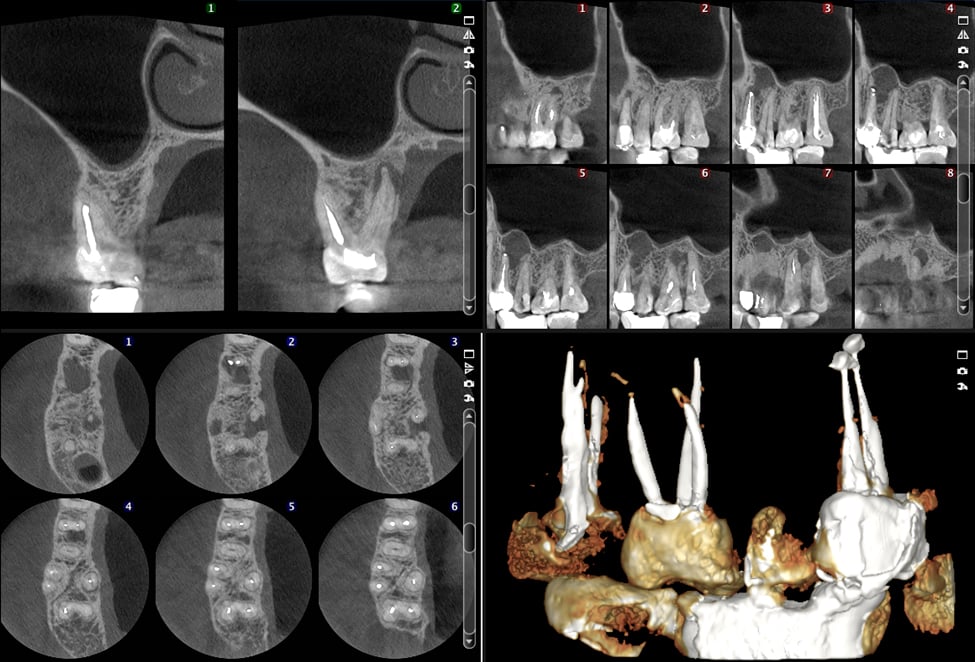 Endodontic imaging software
