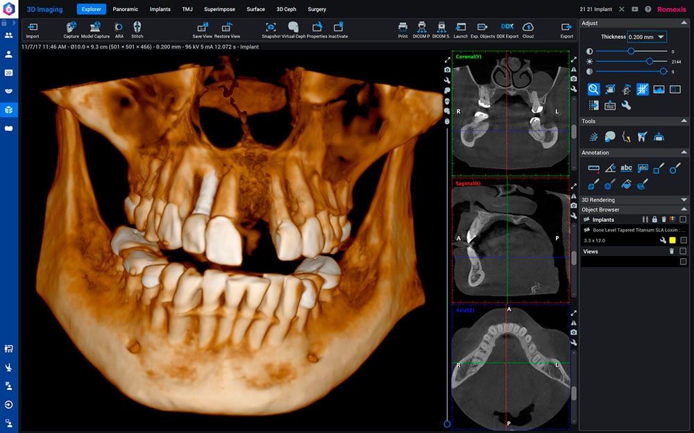 romexis-new-3d-rendering-style.jpg