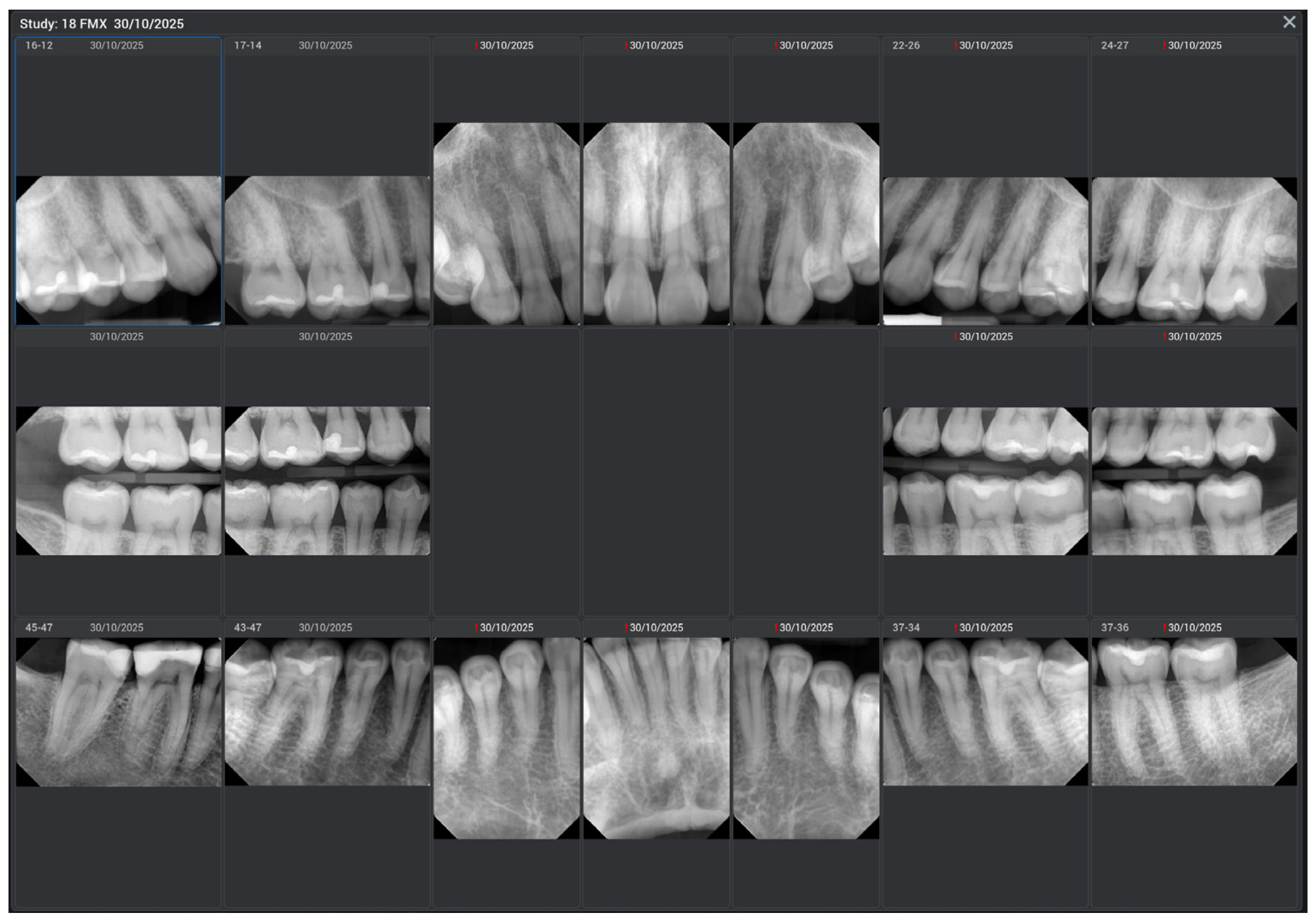 Romexis 7 software release (6.5.2)