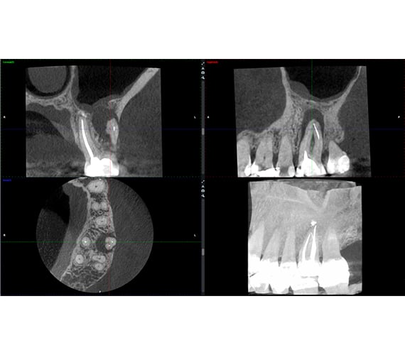planmeca-viso-g3-endodontic-imaging.jpg