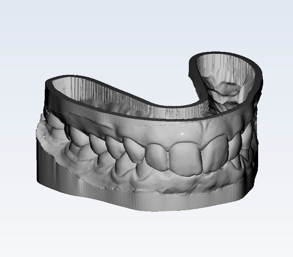 Planmeca Romexis Model Analyser 3D model