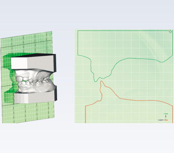 Planmeca Romexis Ortho studio analyses and measurements