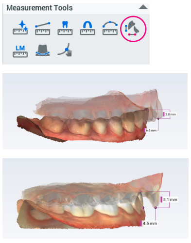 Romexis 7 software release (6.5.2)