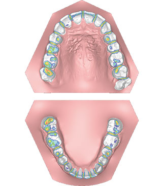 Planmeca Romexis 3D Ortho Studio