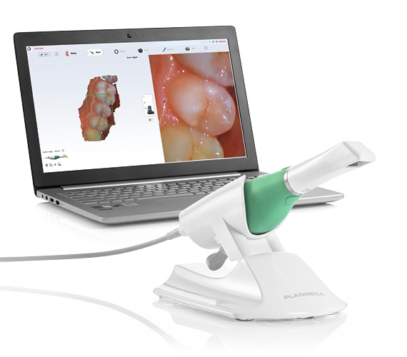 Planmeca Emerald dental scanner digital accuracy