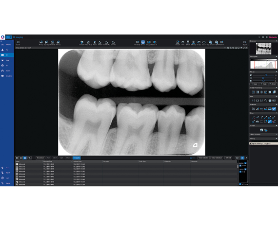 Planmeca ProScanner 2.0 - Romexis integracija