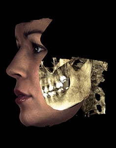 Measure distances and relationships between bone and soft tissue 