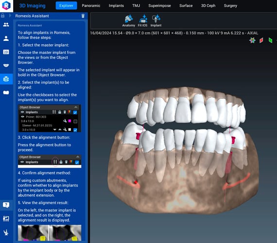 Romexis superior usability