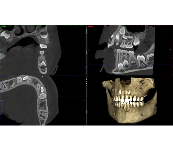 planmeca-viso-g3-clinical-images.jpg