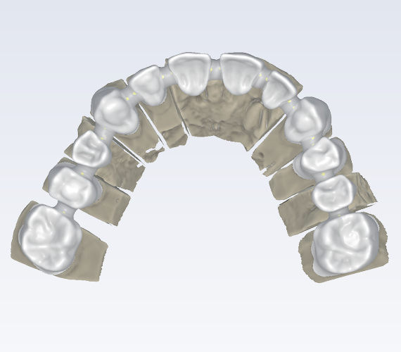 Planmeca PlanCAD Premium software for wide range of applications